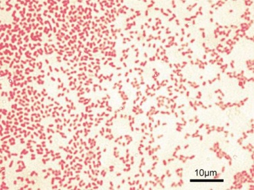 proteus vulgaris gram stain 1000x