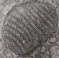 A cross-section of a mitochondrion under an electron microscope